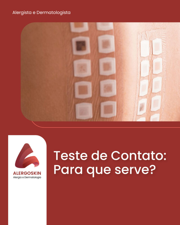 teste-de-contato