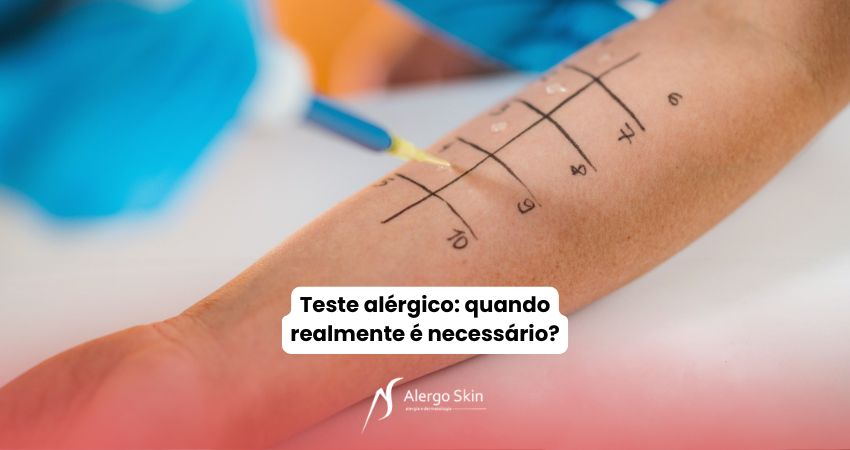 teste-alergico