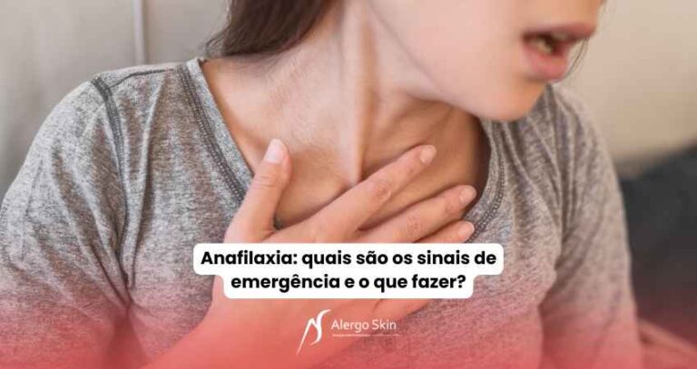 anafilaxia-o-que-fazer