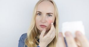 alergia-cosmeticos-irritando-a-pele